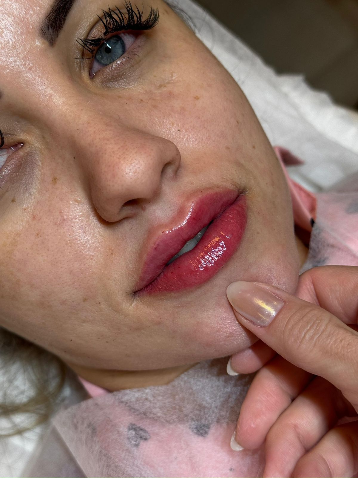 Preenchimento Labial